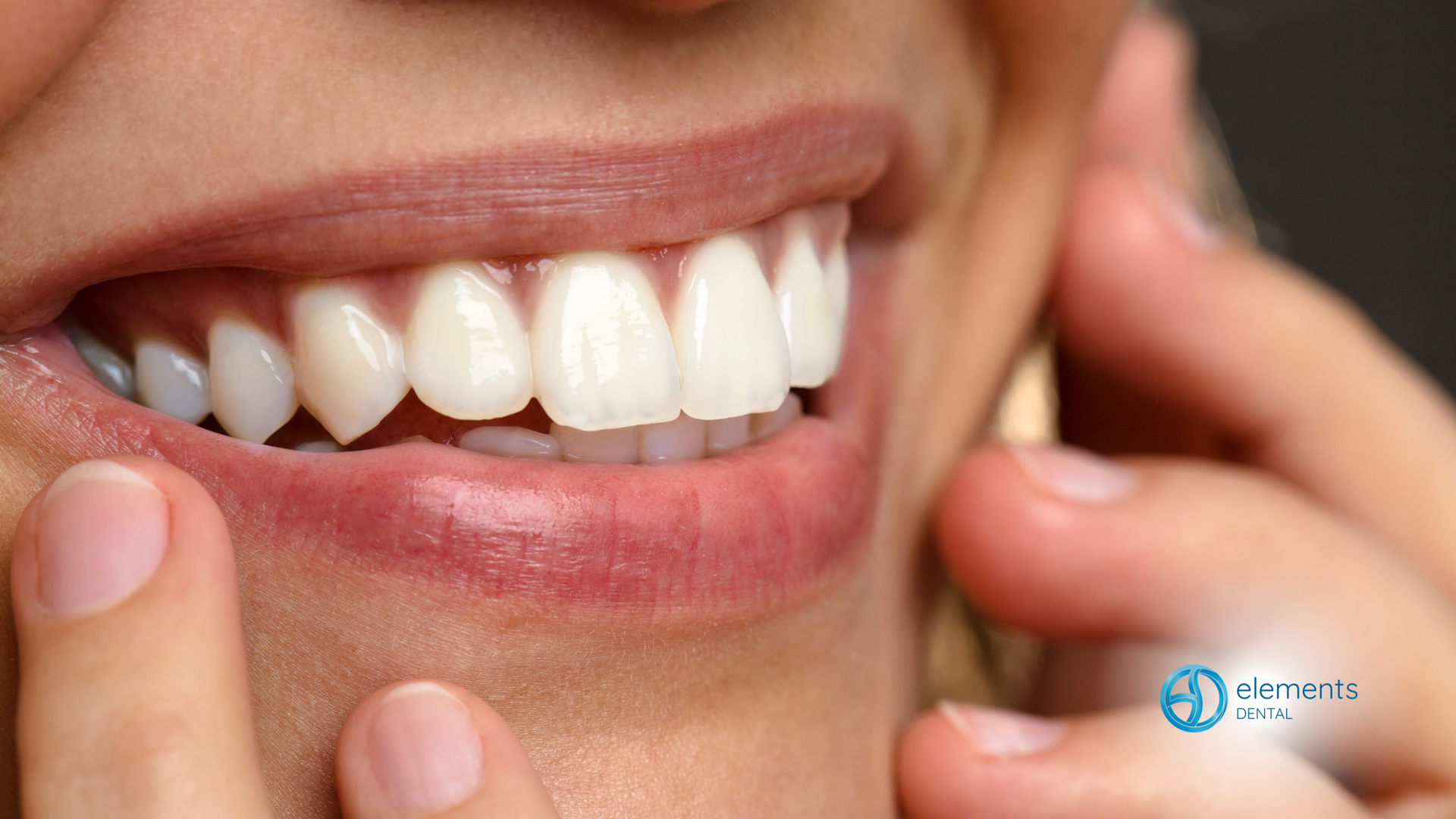 A close up of a woman 's mouth with white teeth.