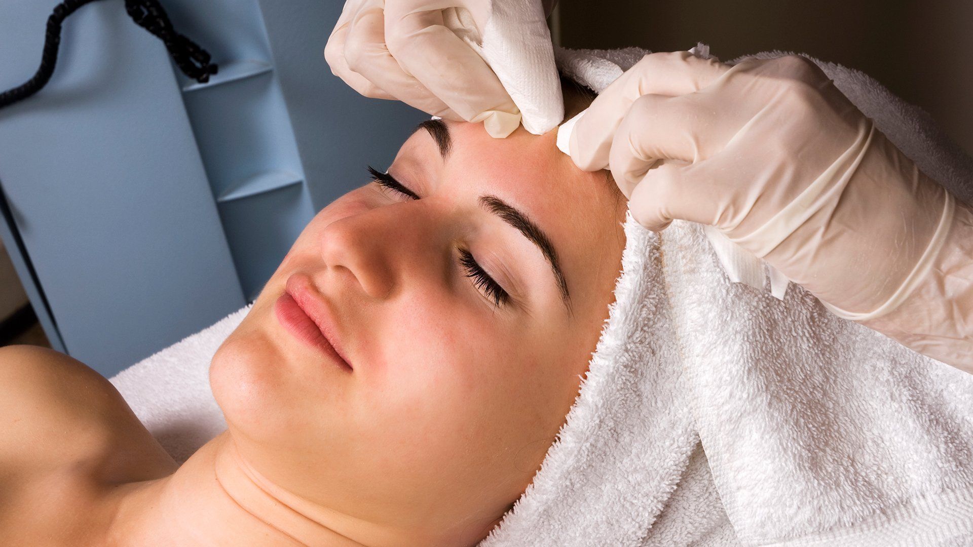 Acne Removal — Redlands, CA — Aesthetic Skin And Laser