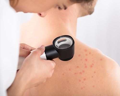 Acne On Skin — Redlands, CA — Aesthetic Skin And Laser