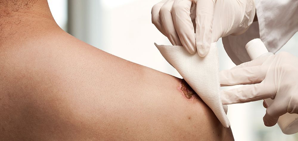 A person is getting a bandage on their shoulder. | Redlands, CA | Aesthetic Skin and Laser