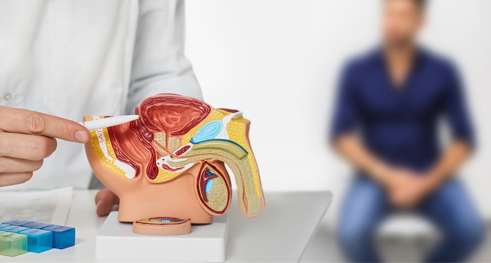 A doctor is pointing at a model of the male reproductive system.
