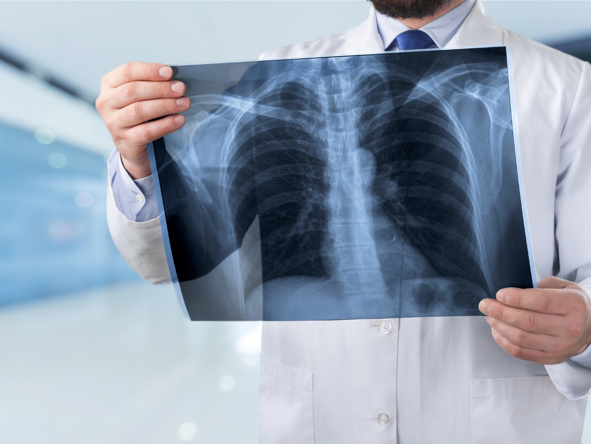 Doctor holding an X-ray of a chest in a bright clinic