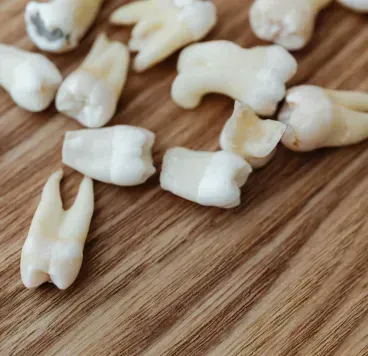 banana-river-dental-extractions-image