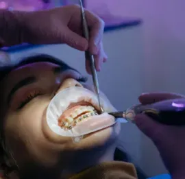 banana-river-dental-root-canal-therapy-image