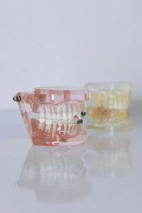 banana-river-dental-dentures-partials-image