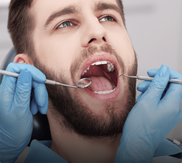 Proteção Veicular para Carros