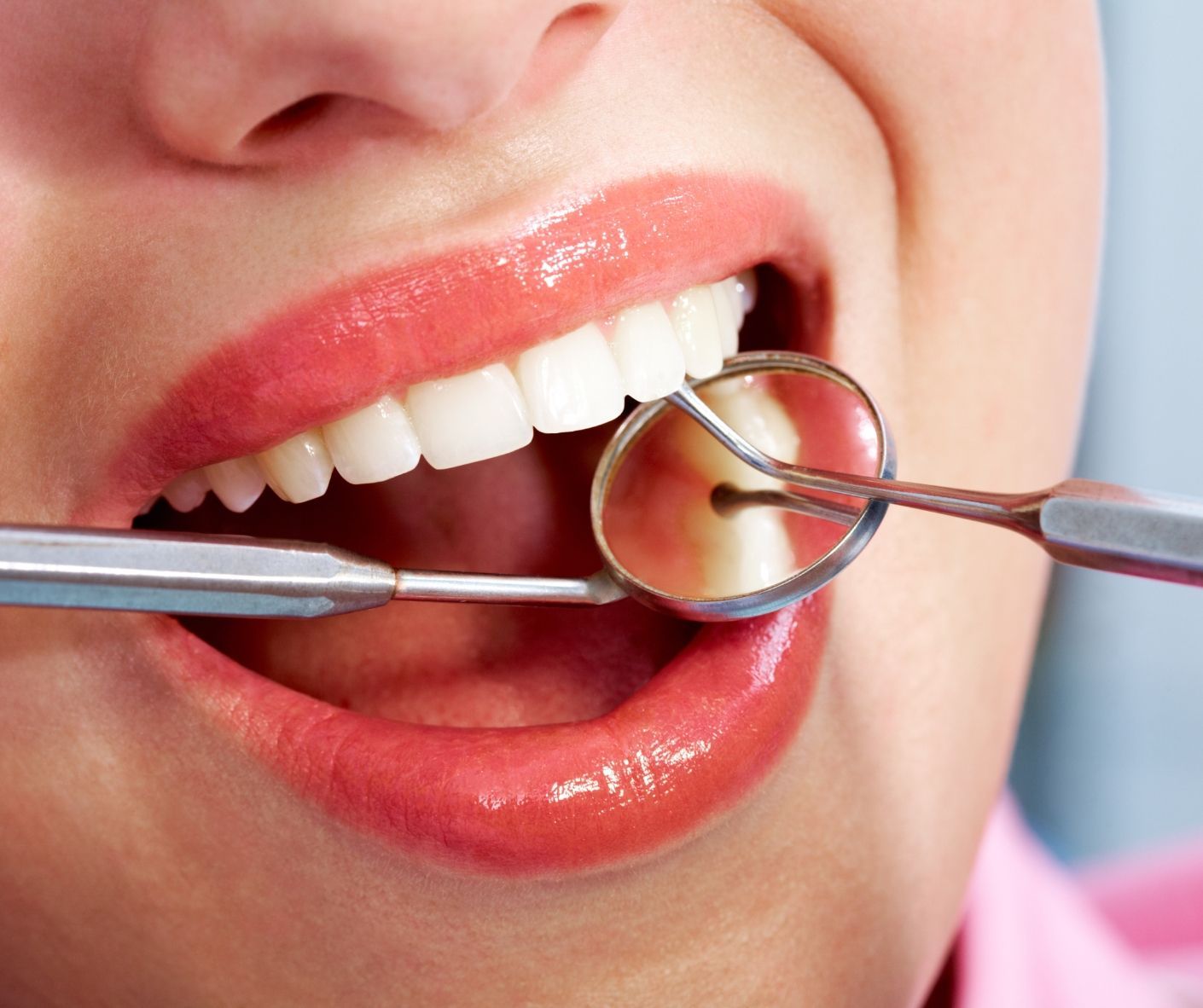 Dental hygienist cleaning a patient’s teeth during a routine appointment.