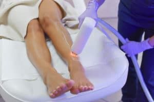 A woman is getting a laser hair removal treatment on her legs.