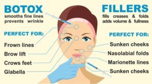 A diagram of a woman getting botox and fillers on her face.