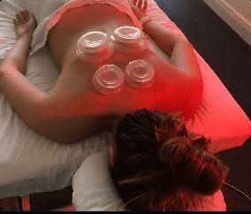 Dynamic Cupping Service