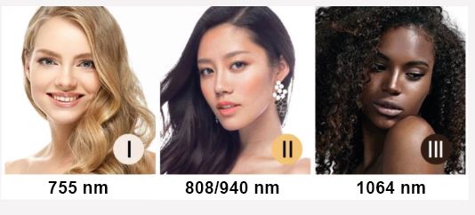 Es werden drei verschiedene Frauentypen mit den Zahlen 755 nm 808 940 nm und 1064 nm angezeigt