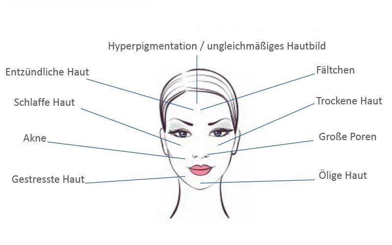 Ein Diagramm des Gesichts einer Frau mit verschiedenen Hauttypen.