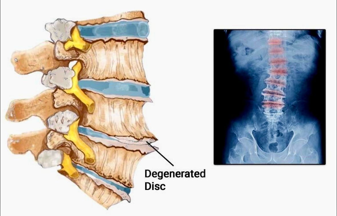 Lovely Senior Couple — Winchester, KY — Miller Chiropractic Centre Inc PSC Lovely Senior Couple — Winchester, KY — Miller Chiropractic Centre Inc PSC