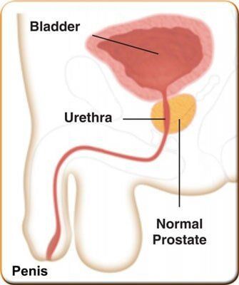 Normal Prostate — Hickory, NC — Viewmont Urology Clinic, PA