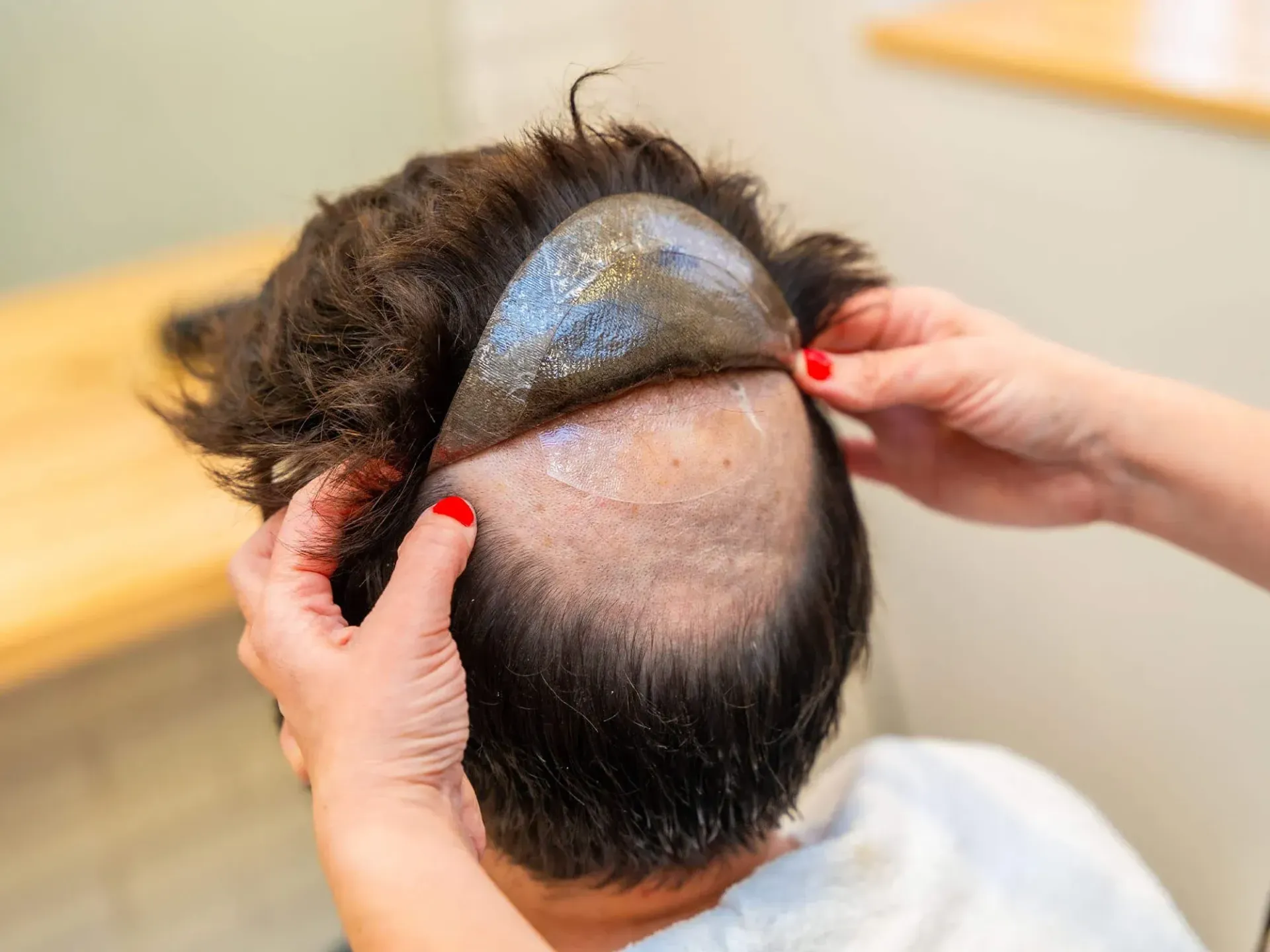 Person having hairpiece applied; hands holding the piece over scalp.