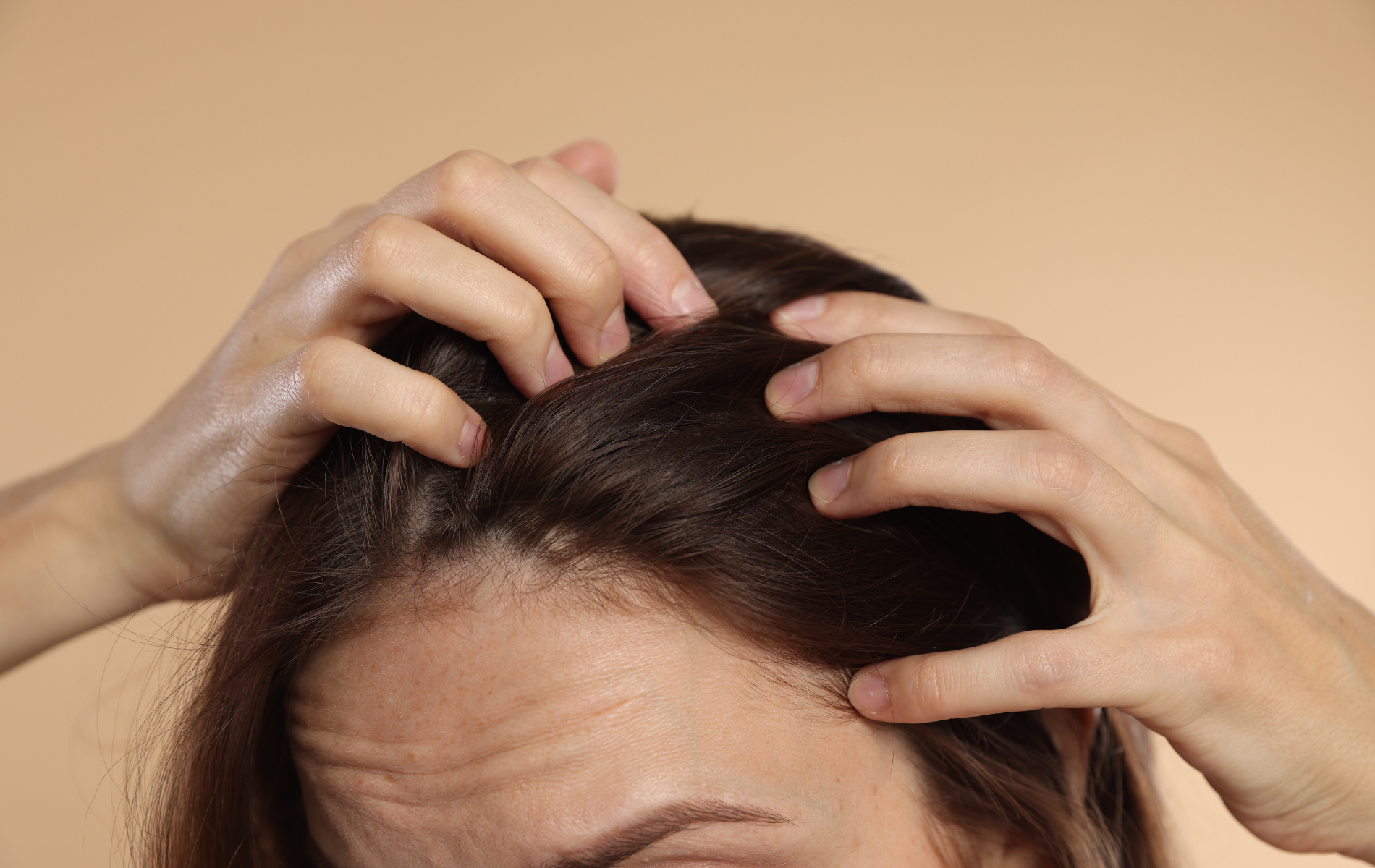 Person massaging scalp with both hands, close-up against a beige background.