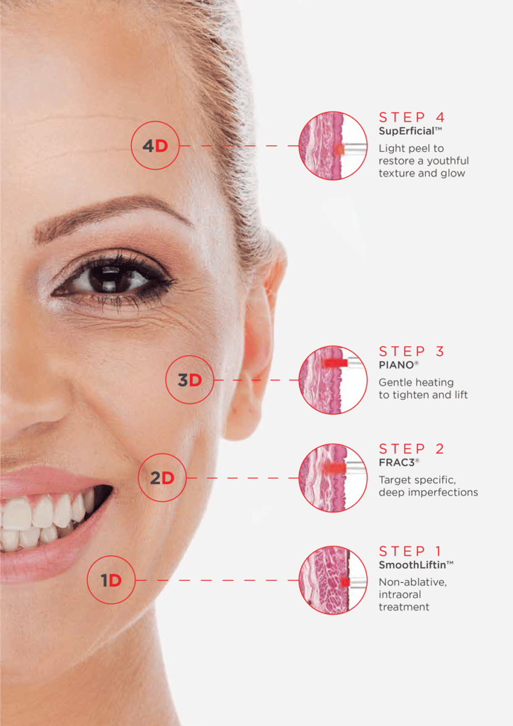 Resultaten van Fotona 5D laserbehandeling bij Haar en Huid Kliniek in Tessenderlo voor een jeugdige huid in België en Nederland