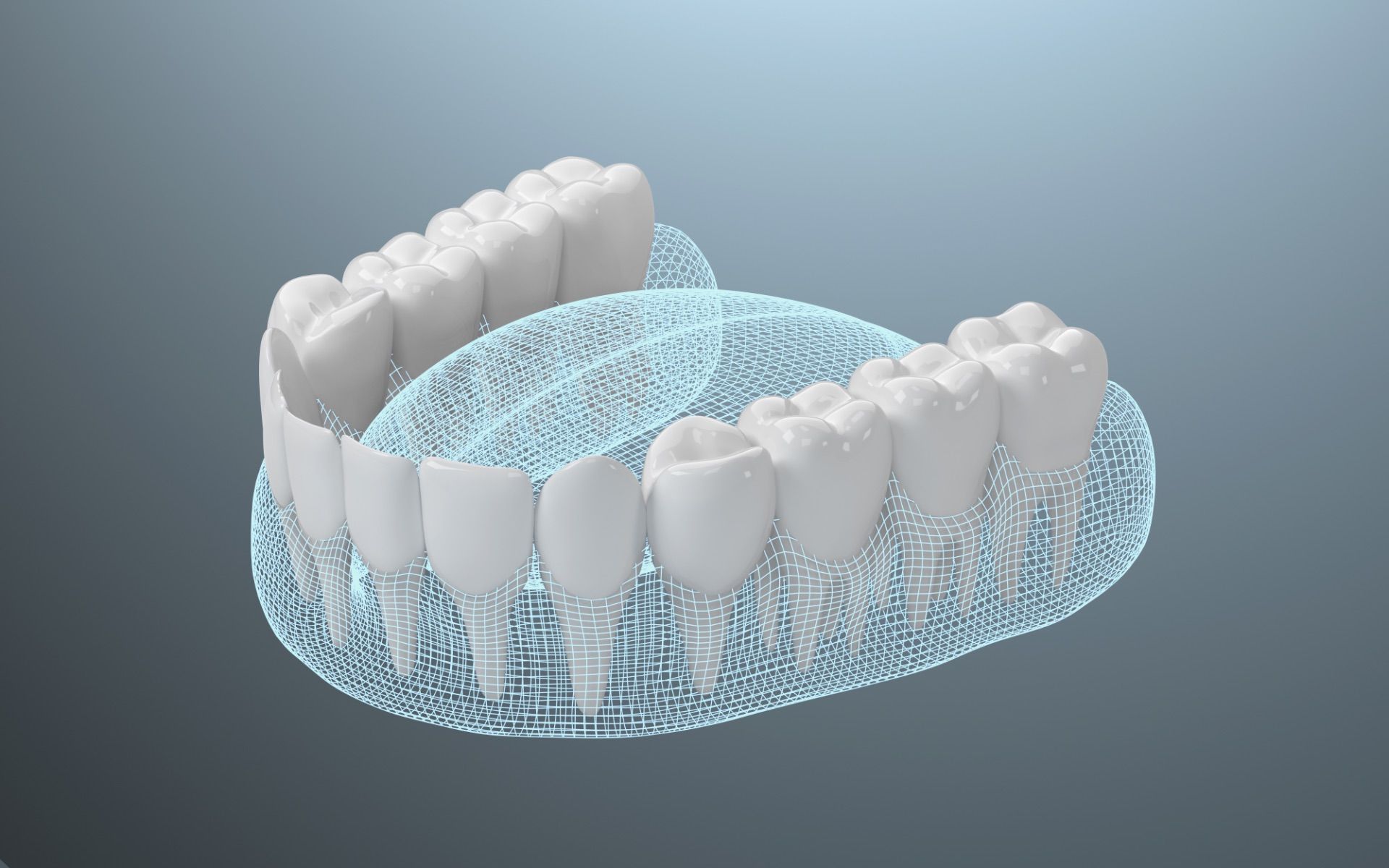 render 3d di un trattamento ai denti