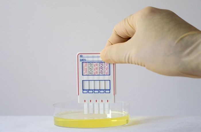 A person is holding a test kit over a petri dish of urine.
