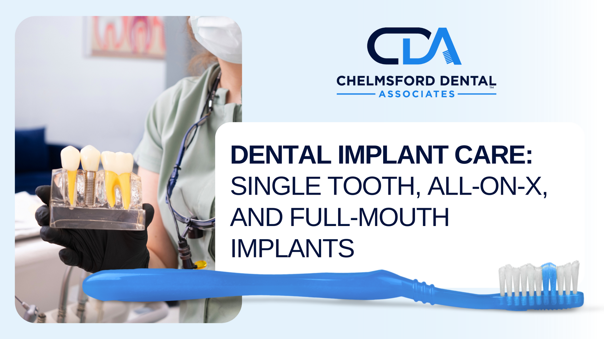 Dental implant care single tooth all-on-x and full mouth implants