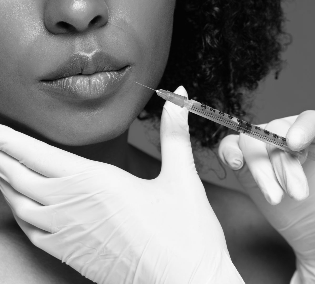 Gloved hand injecting needle into woman's lip.