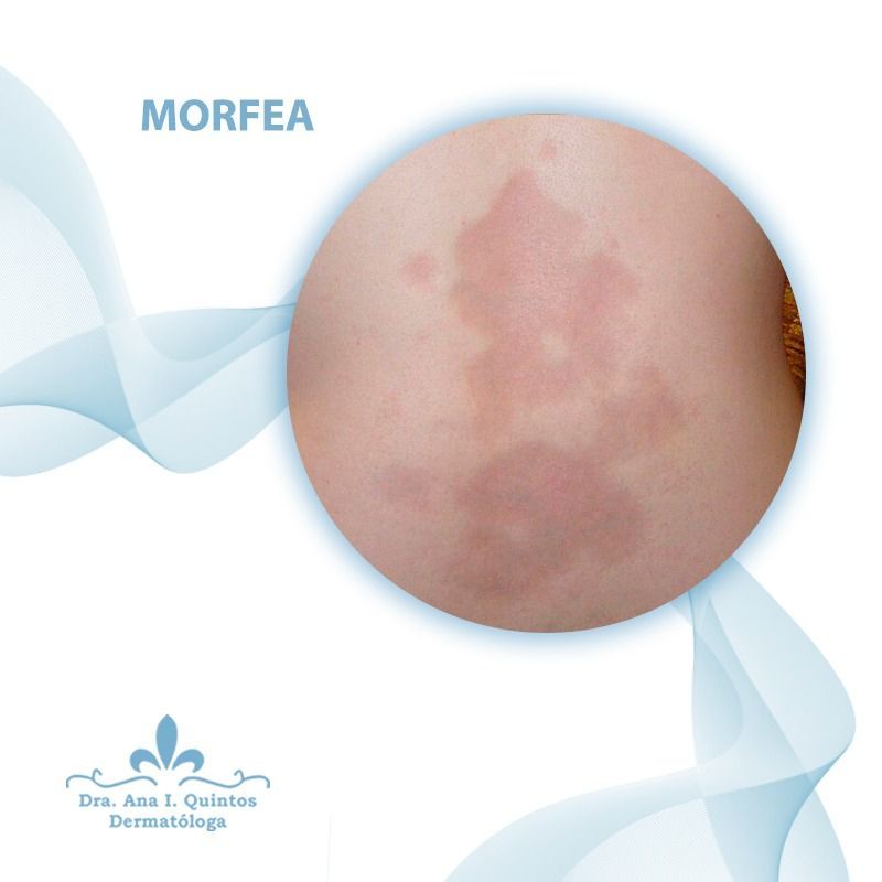 Dra. Ana Quintos  - DERMATOLOGA