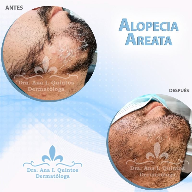 Dra. Ana Quintos  - DERMATOLOGA