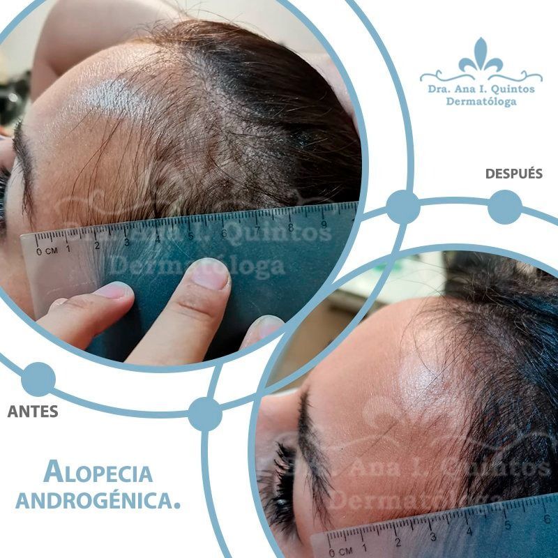 Dra. Ana Quintos  - DERMATOLOGA