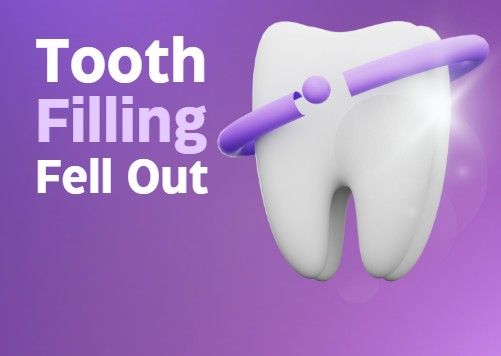 Tooth Filling Fell Out