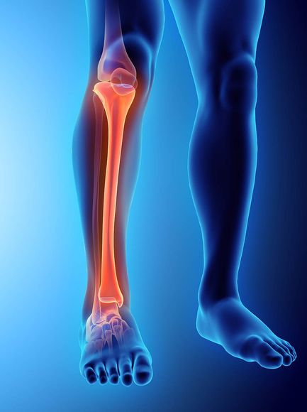 Sostituzione articolare di ginocchio mediante trapianto osteocartilagineo