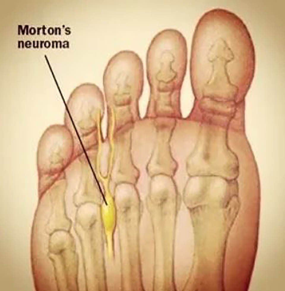 Revisione interventi chirurgici