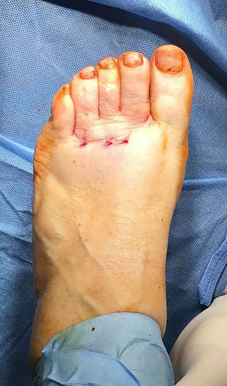 Chirurgia mini-invasiva