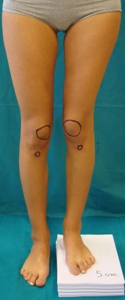 Chirurgia specialistica del retropiede