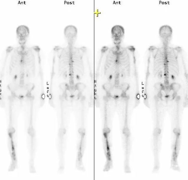 Chirurgia specialistica del retropiede