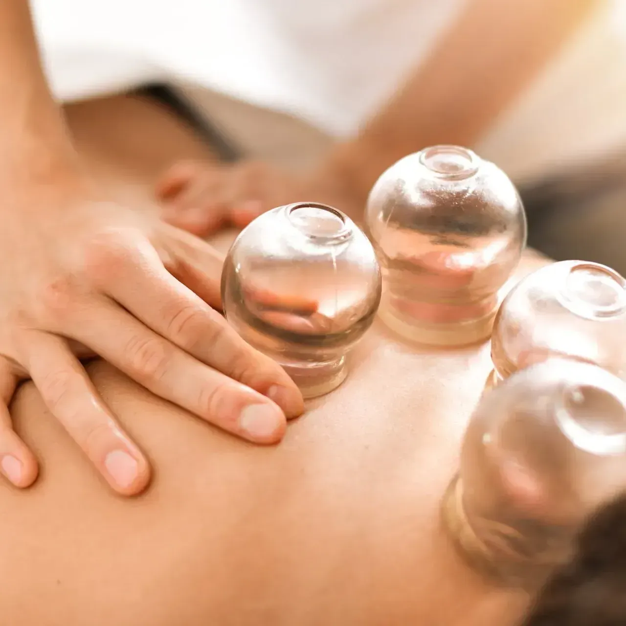 a person is getting cupping therapy