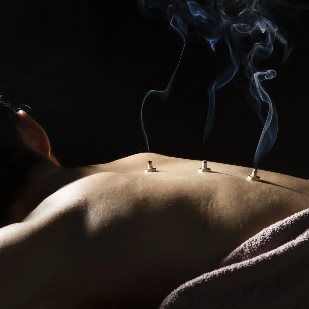 moxibustion