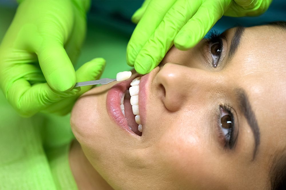 Dentist comparing tooth shade with a color guide in a patient's mouth, wearing green gloves.