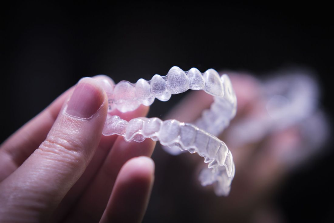 apparecchio dentale trasparente