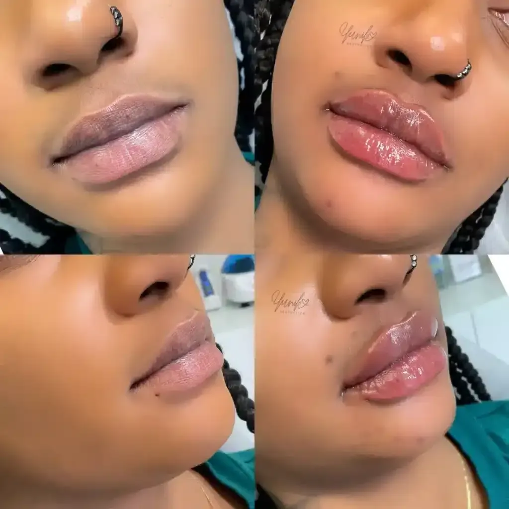 A Collage Close up Of a Woman 's Lips with A Nose Ring
