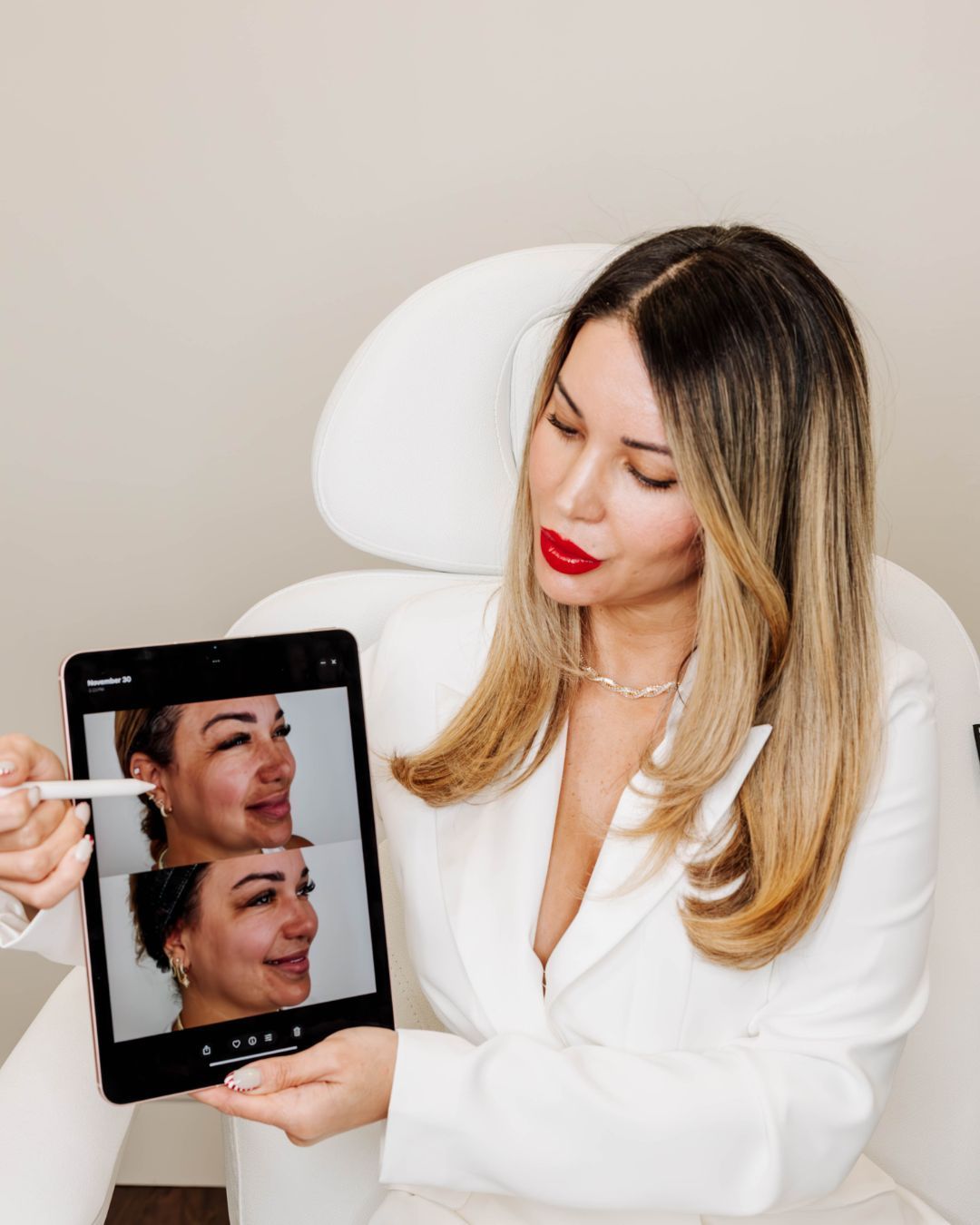 Woman receiving a facial injection in a medical setting, with blue gloved hands holding the syringe near her cheek.