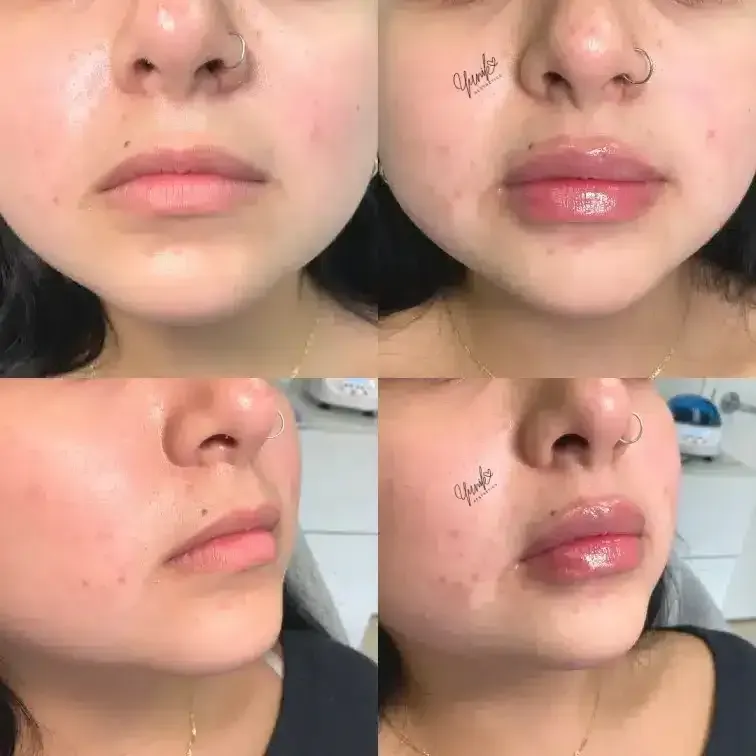 A Woman with A Nose Ring and A Tattoo on Her Face.