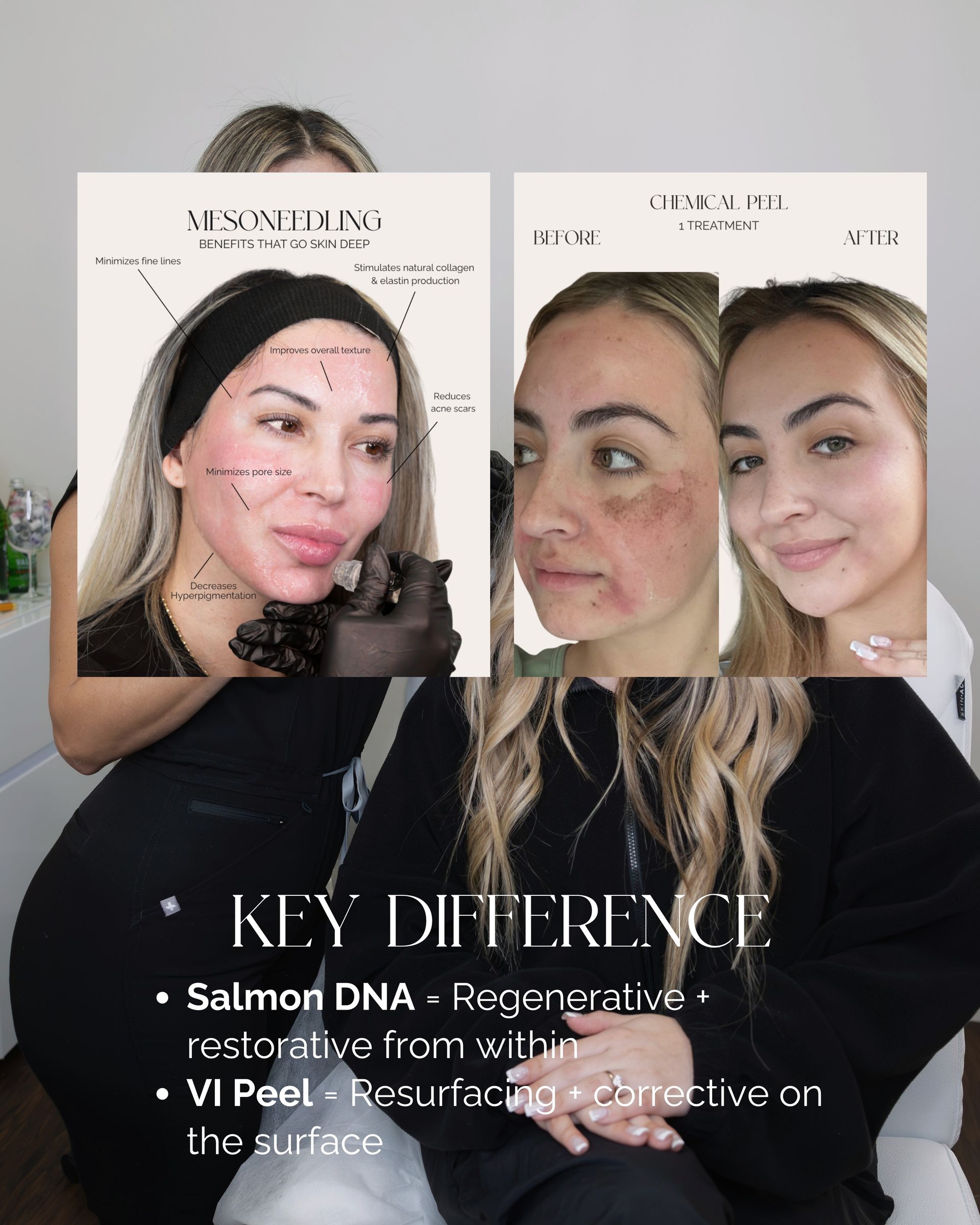 Before-and-after facial treatment collage with three close-up portraits and text about salon services