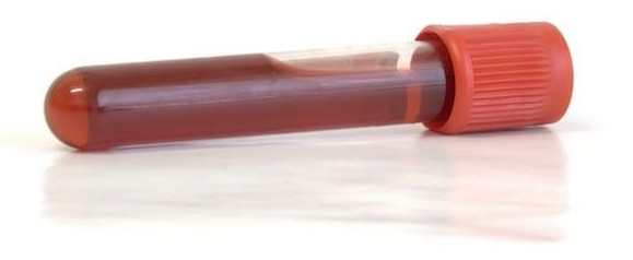 Blood sample in a red-topped tube, lying on a white surface.