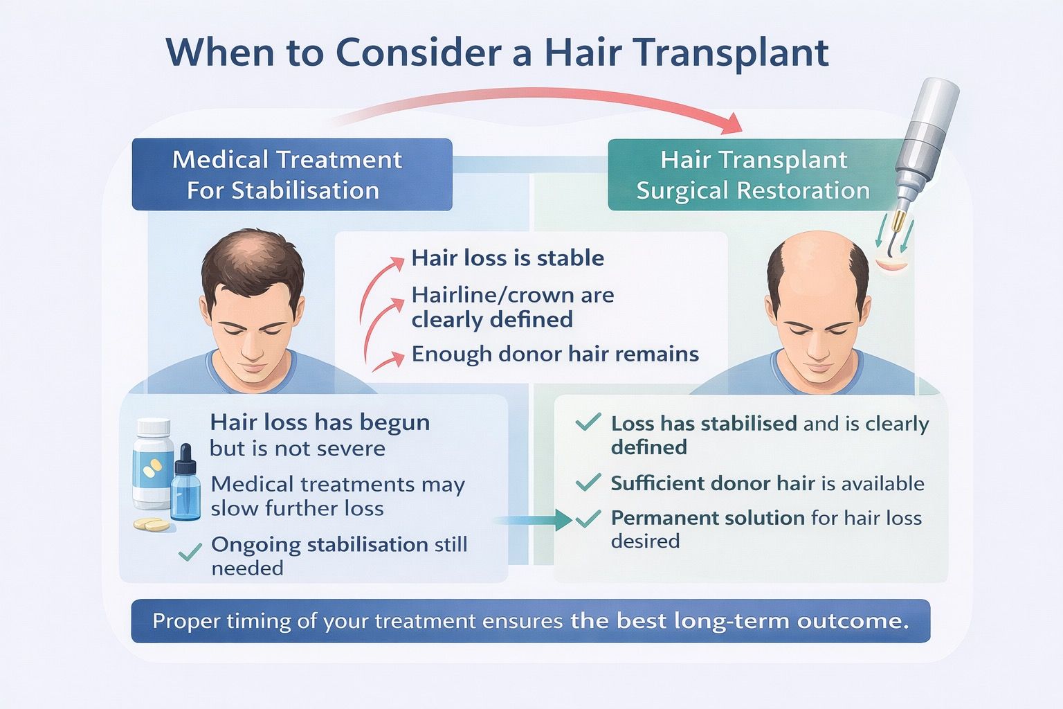 Hair loss progression showing early thinning, moderate recession, and advanced hair loss stages