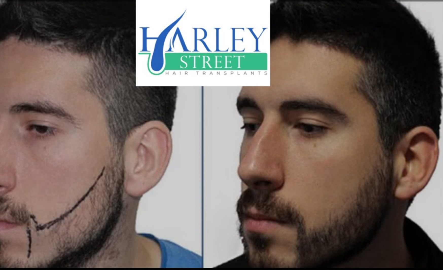 An Asian male with a full beard