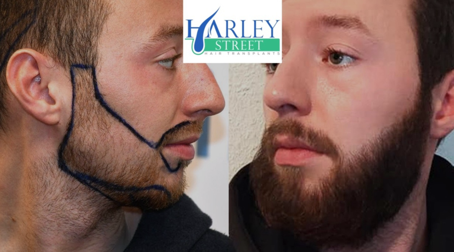 A side profile of a male with a full beard