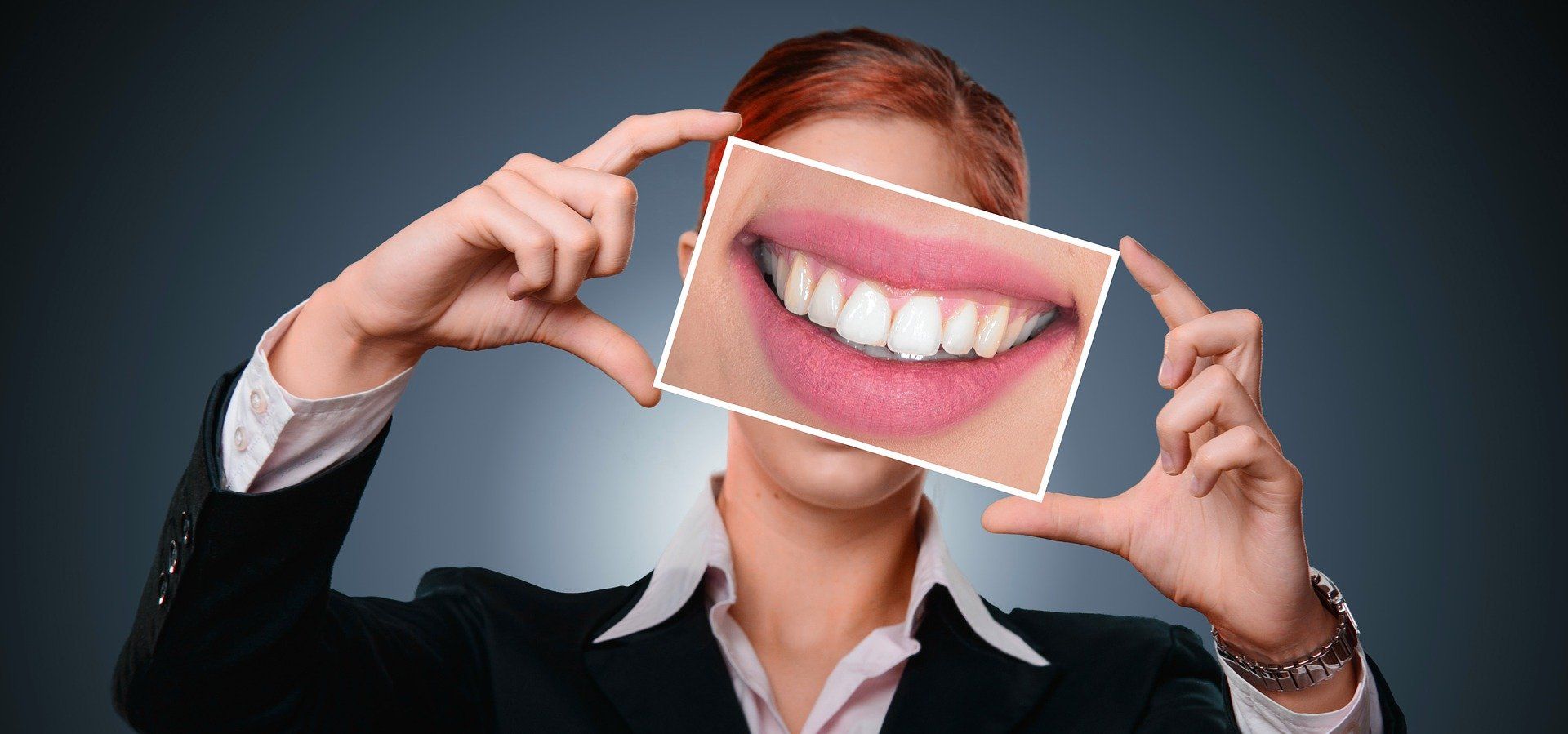 Dental veneers can give a confident smile
