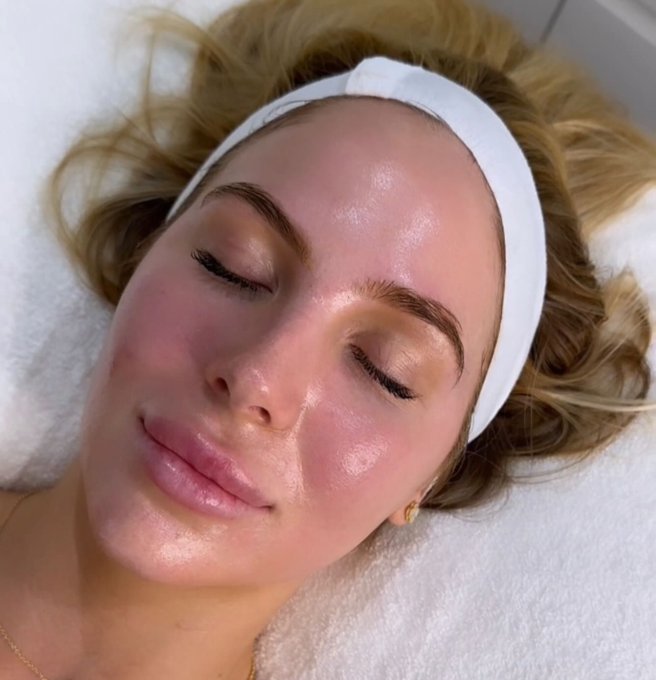 A Woman Wearing a Headband is Laying on a Bed With Her Eyes Closed — Gorjess Aesthetics in Corrimal, NSW