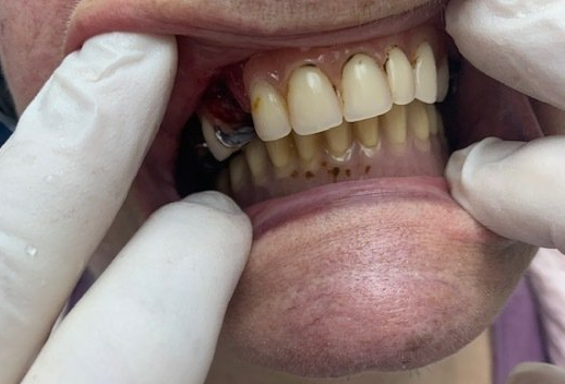 οδοντιατρος καλαμαρια