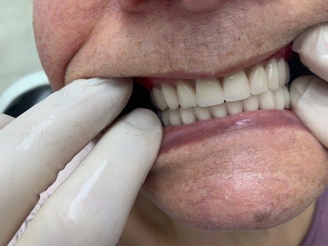 οδοντιατρος καλαμαρια